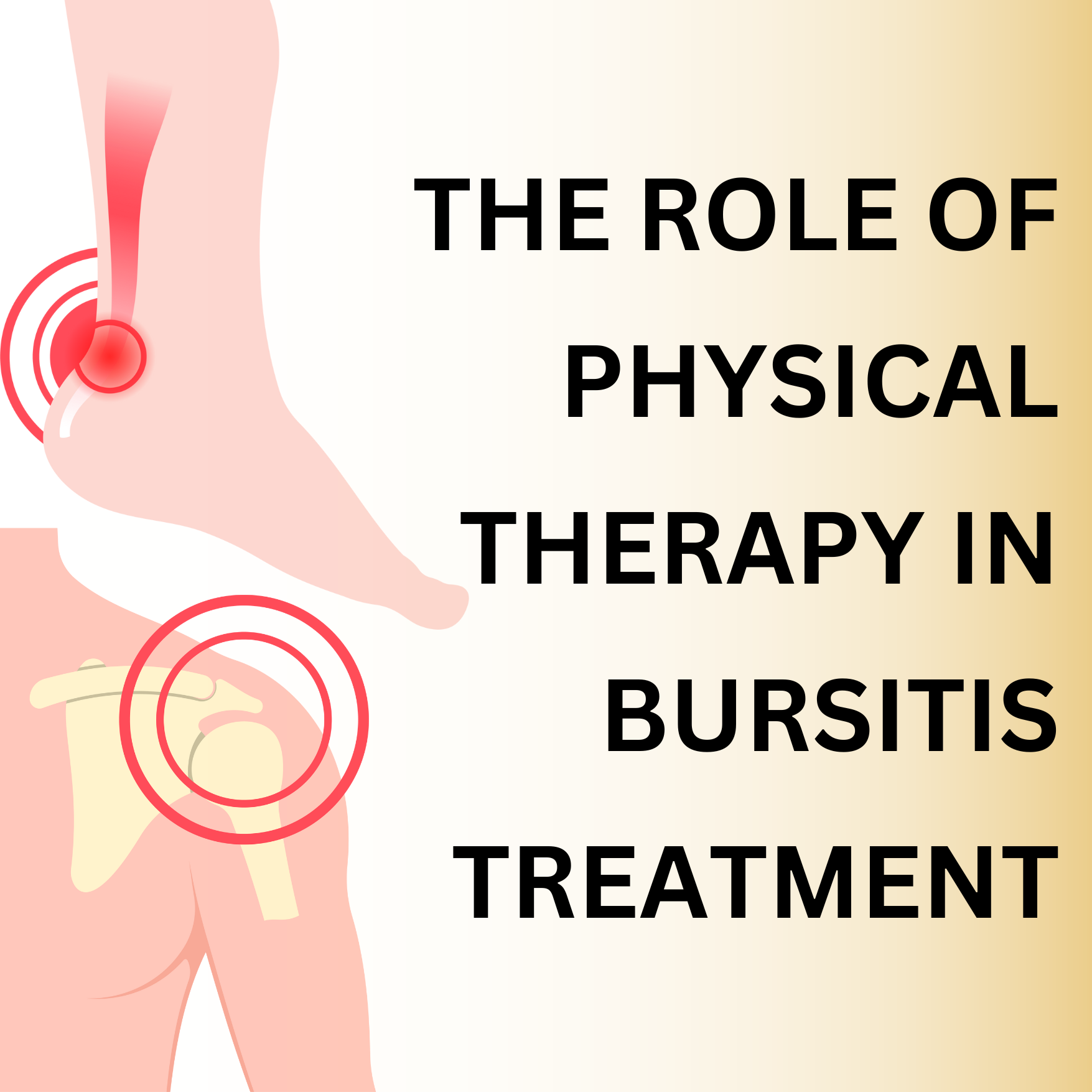 The Role of Physical Therapy in Bursitis Treatment